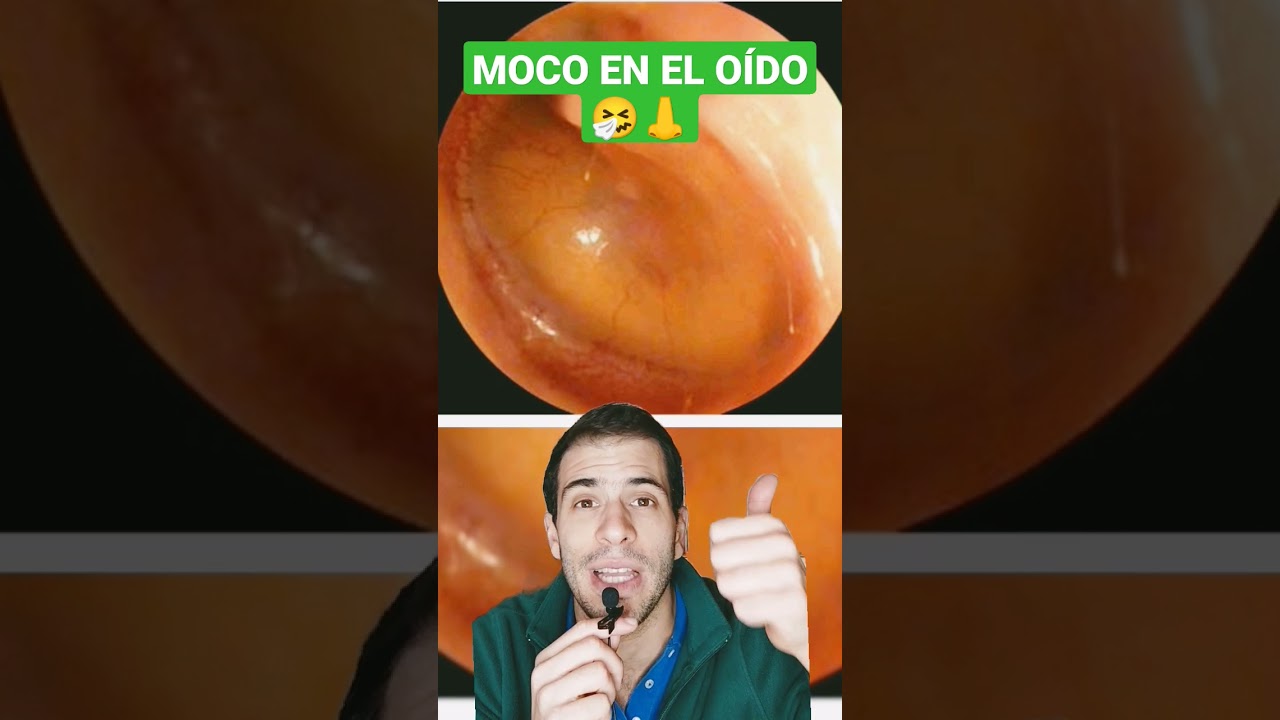 como quitar el taponamiento de oidos por mocos