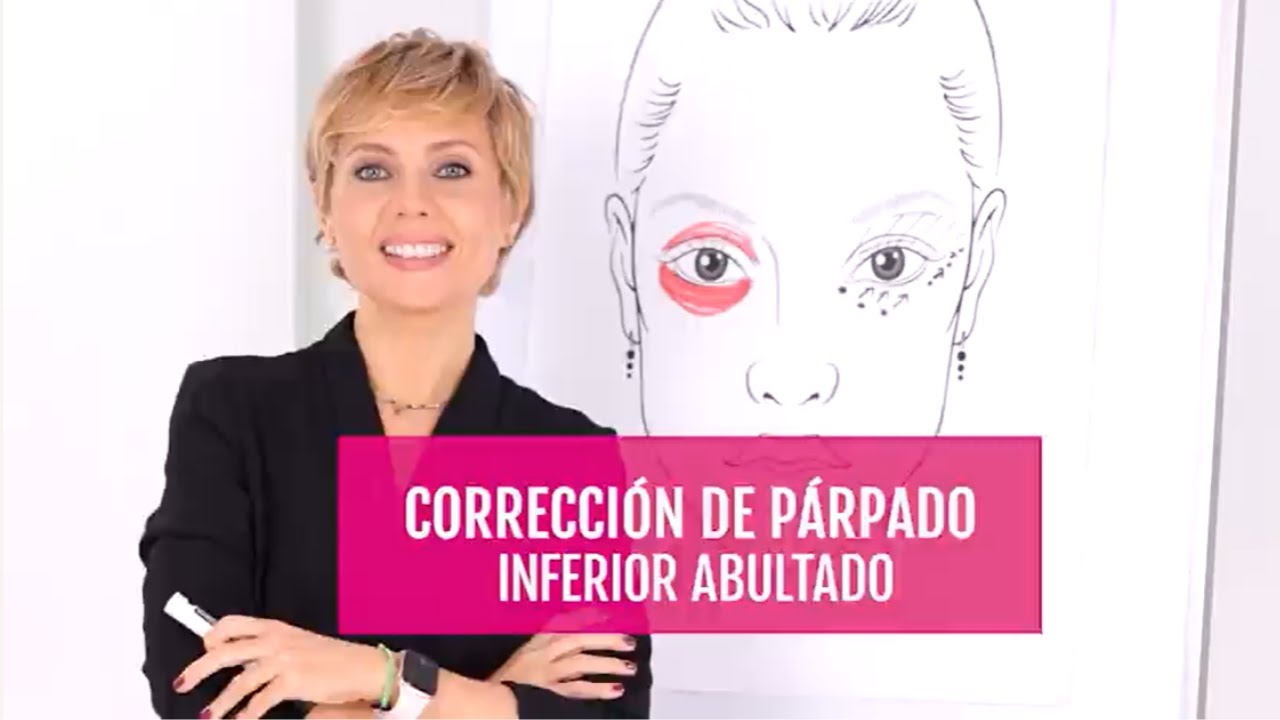 como tapar bolsas en los ojos