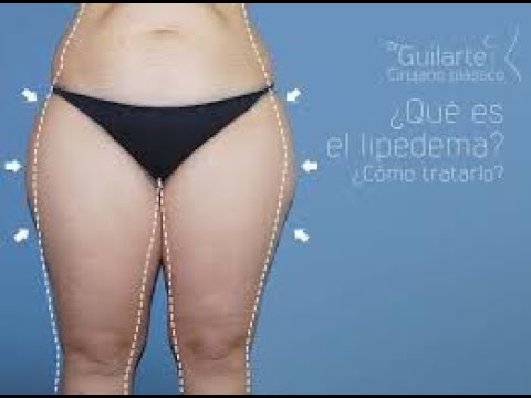 nueva crema reductora mercadona