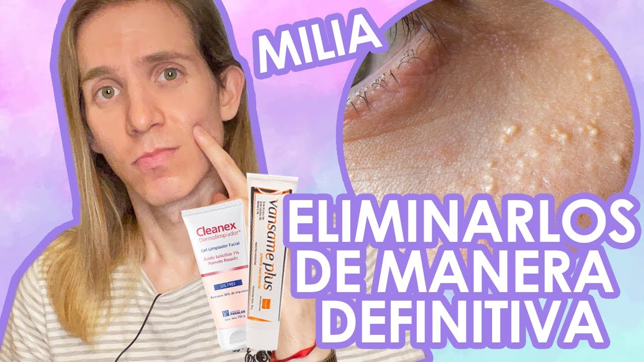 quistes en los ojos