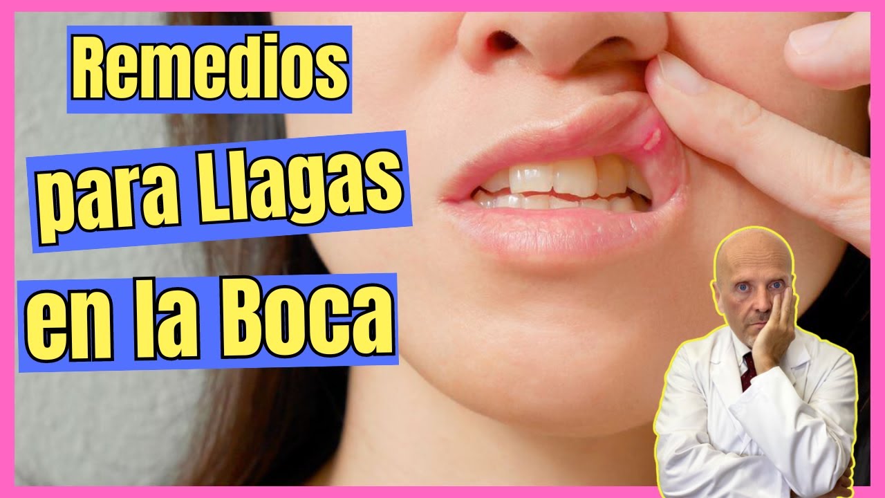 remedios caseros aftas
