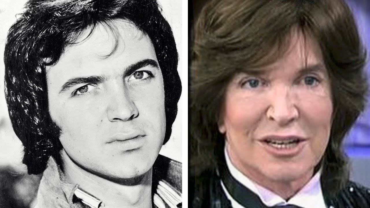 camilo sesto antes y despues