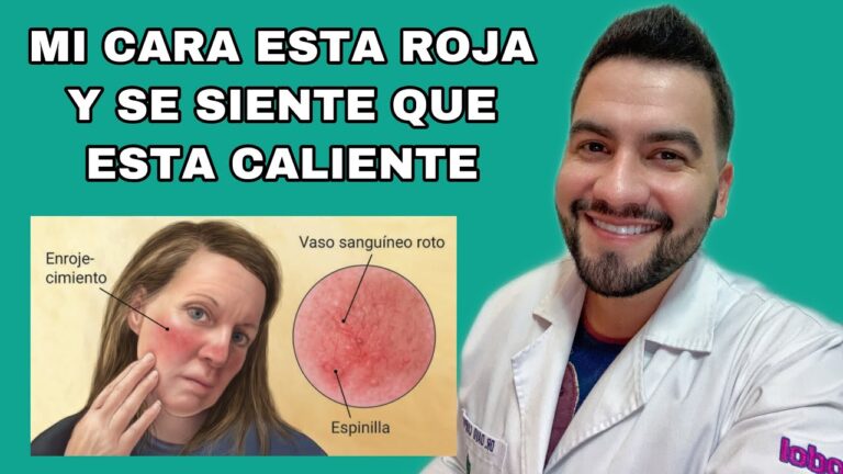 ¿Por Qué Tienes la Cara Roja y Caliente? Causas y Soluciones Efectivas ...