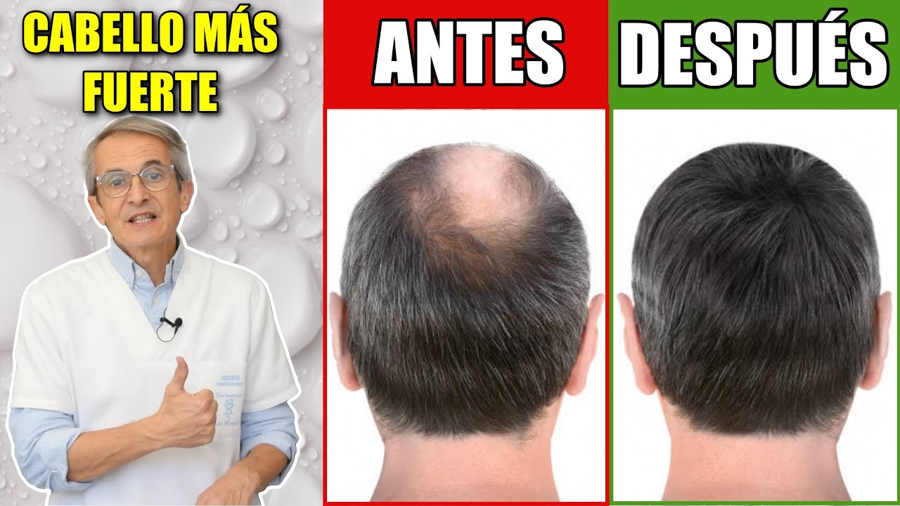como tener pelo fino hombre