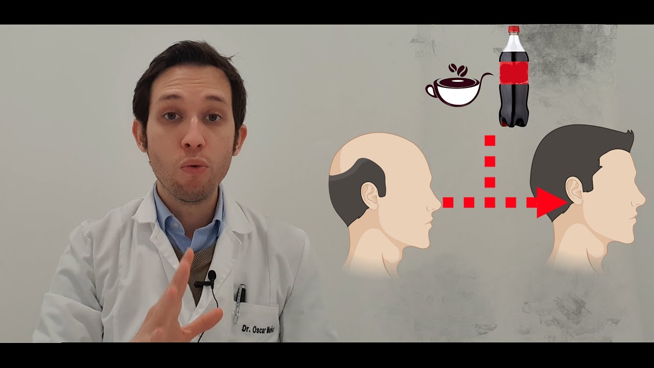el cafe es malo para el pelo