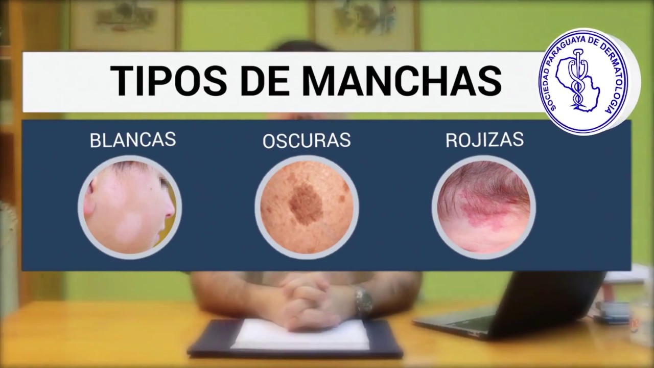 manchas en el pecho
