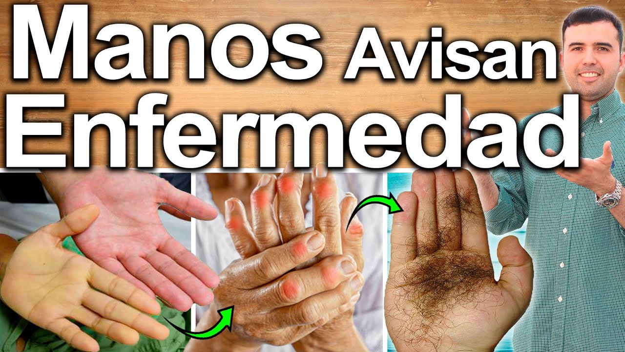 porque se ponen las manos rojas