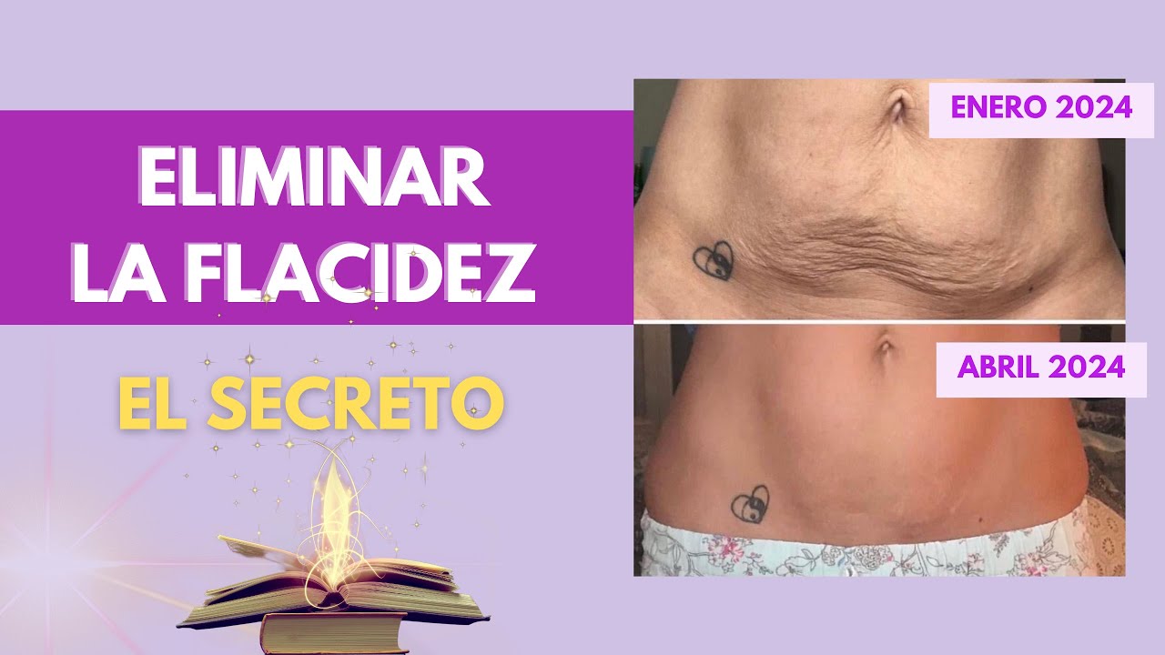 quitar flacidez abdomen