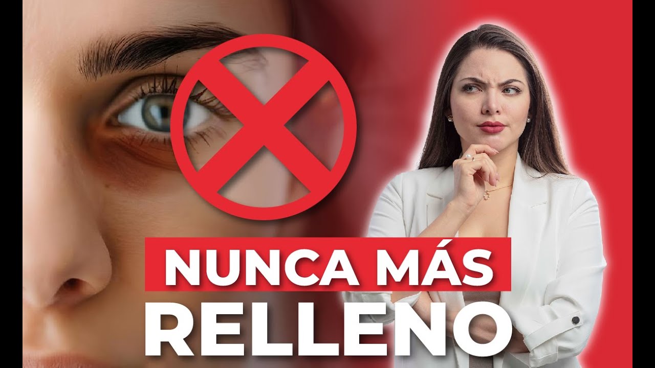 relleno ojeras ácido hialurónico antes y después