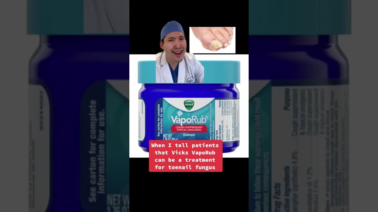 vicks vaporub hongos pies