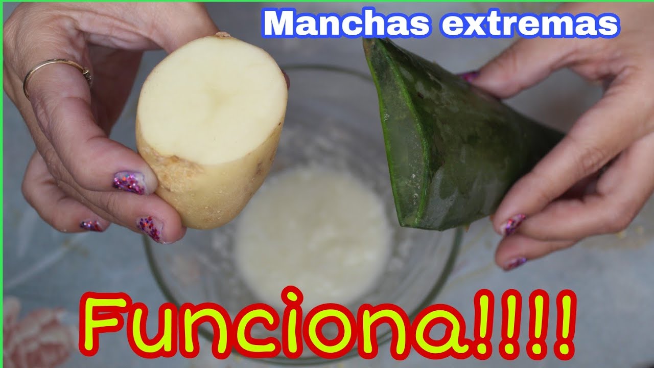 aloe vera quita manchas