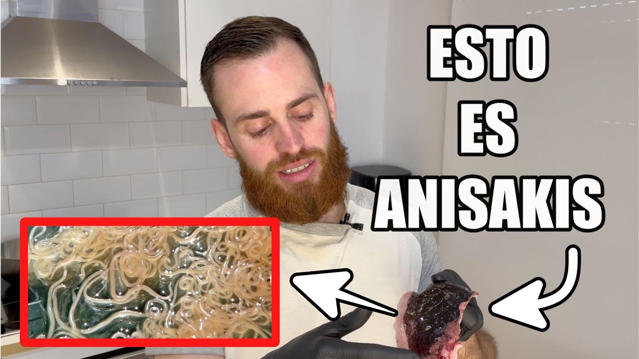 anisakis conservas pescado