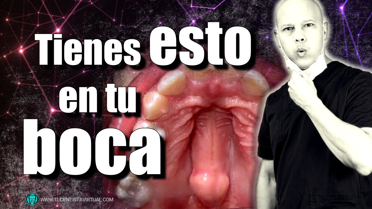 bultito en el paladar