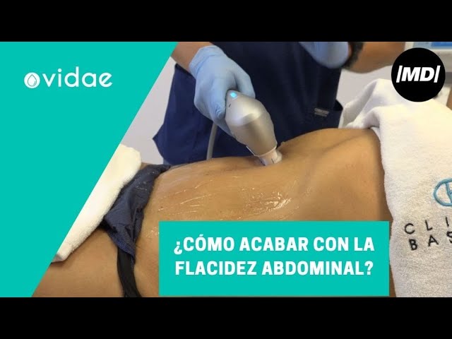 como eliminar la flacidez abdominal