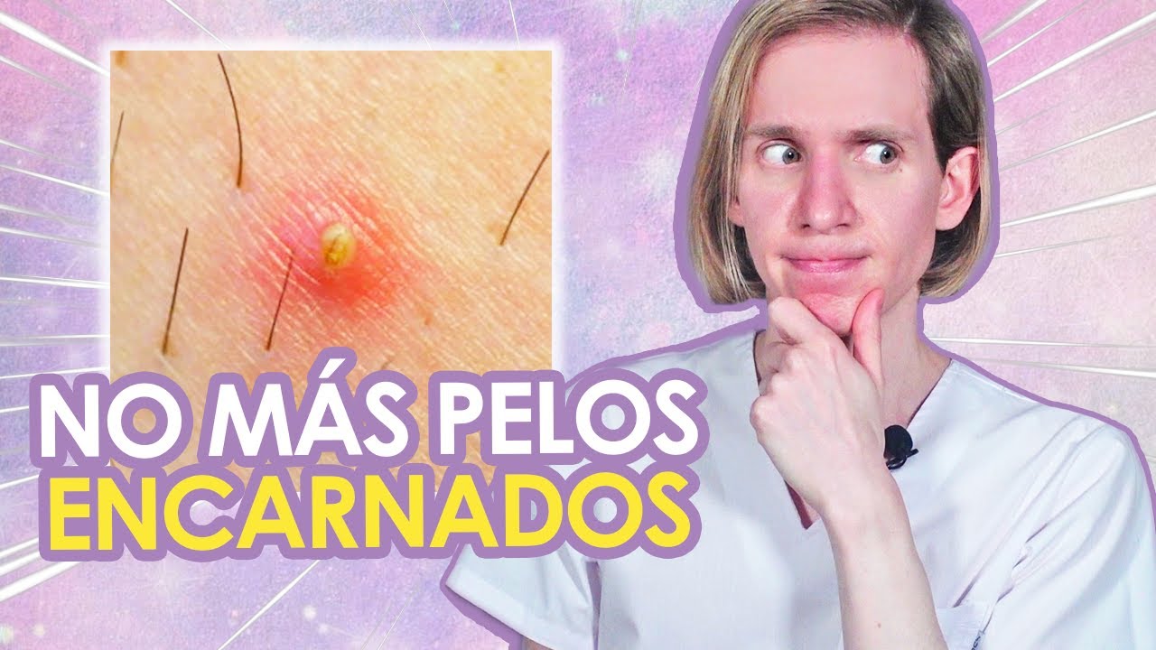 como quitar los granos después de la depilación