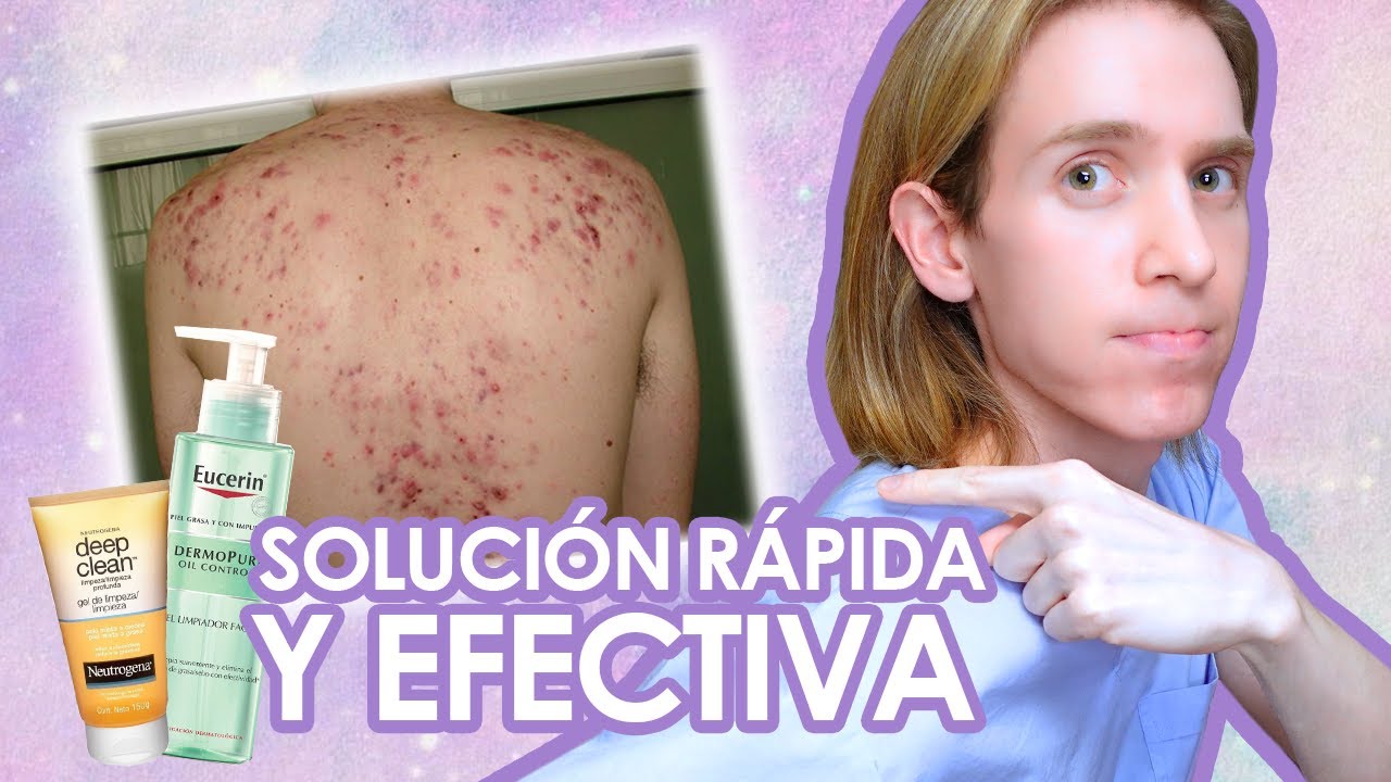crema para los granos de la espalda
