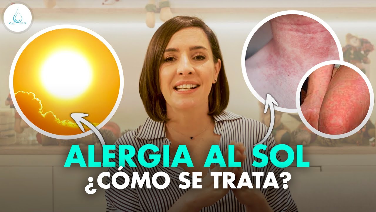 granos alergia al sol