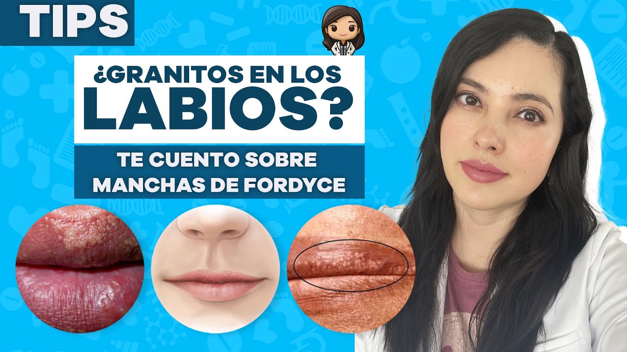 mancha en labios