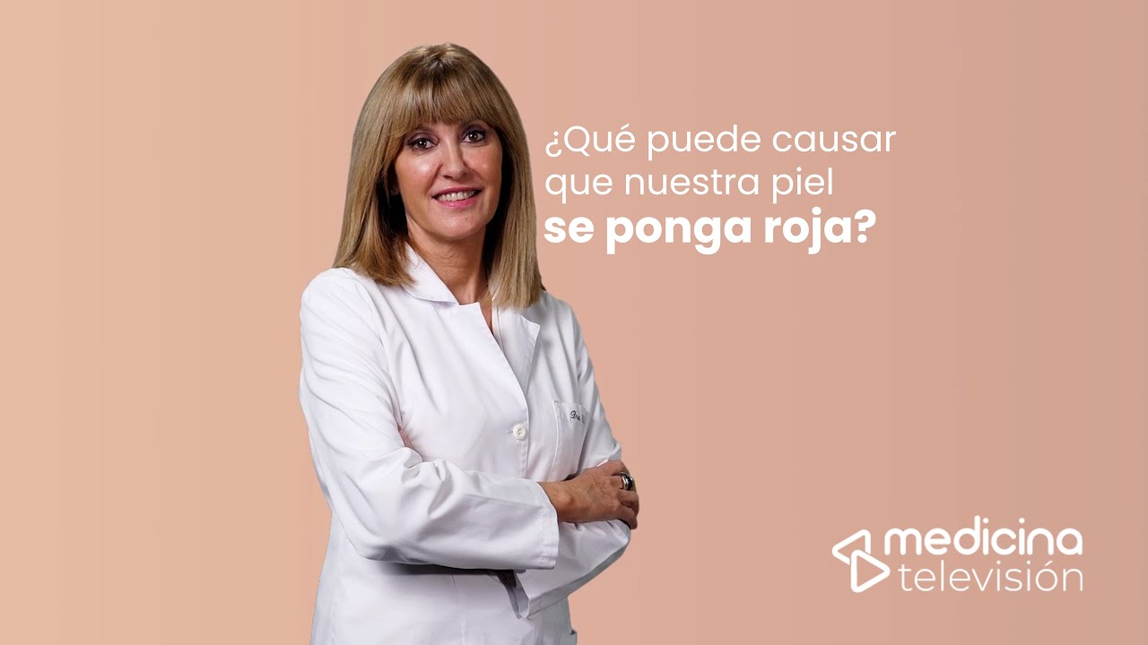 porque tengo la cara roja