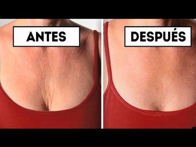 como quitar las arrugas del escote