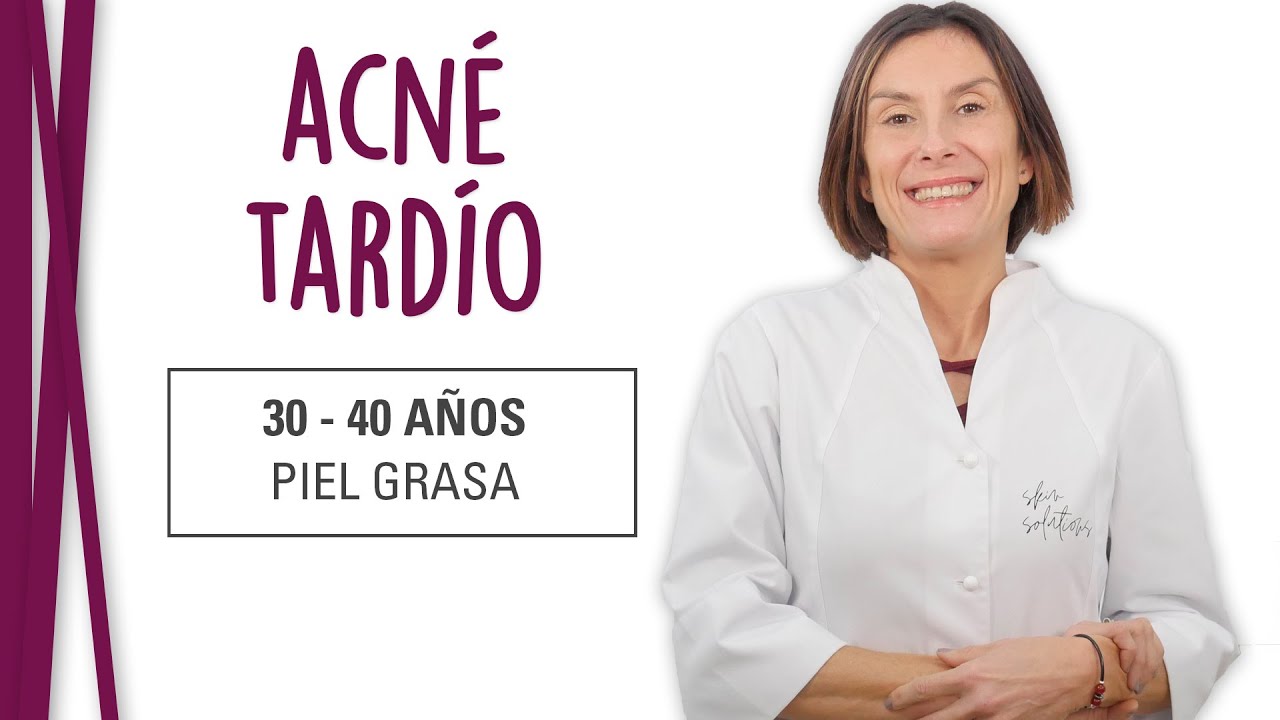 granos en la cara a los 40