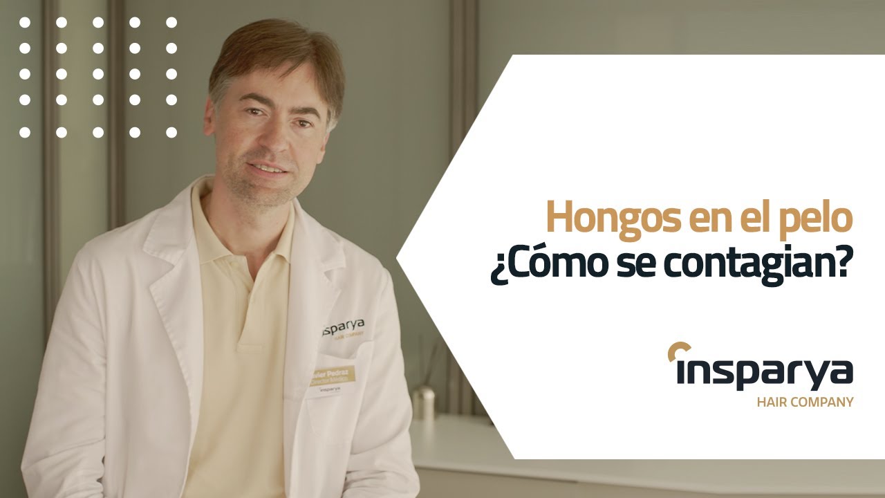 hongos en la cabeza caída de pelo