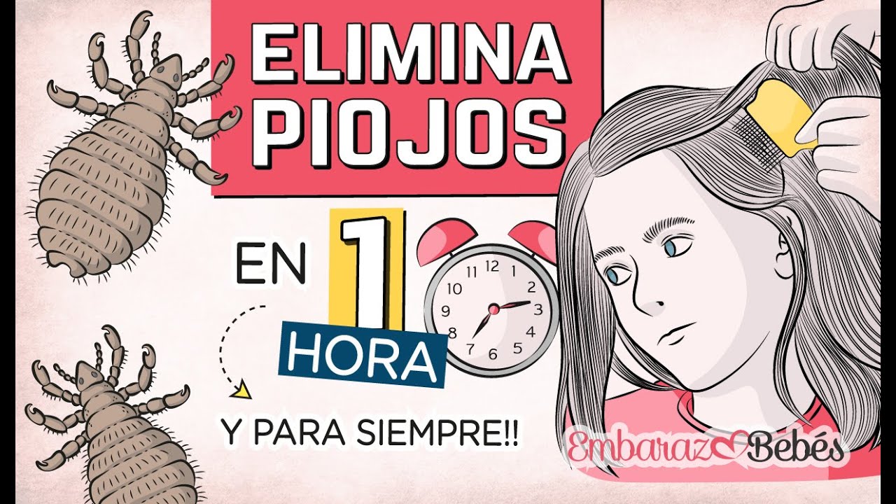 huevos de piojos o caspa