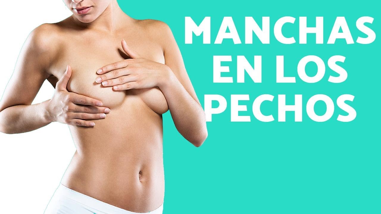 manchas pezones