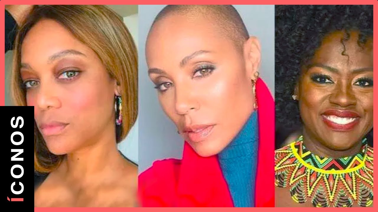 mujer alopecia femenina famosas
