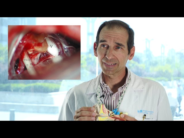 oído taponado tumor