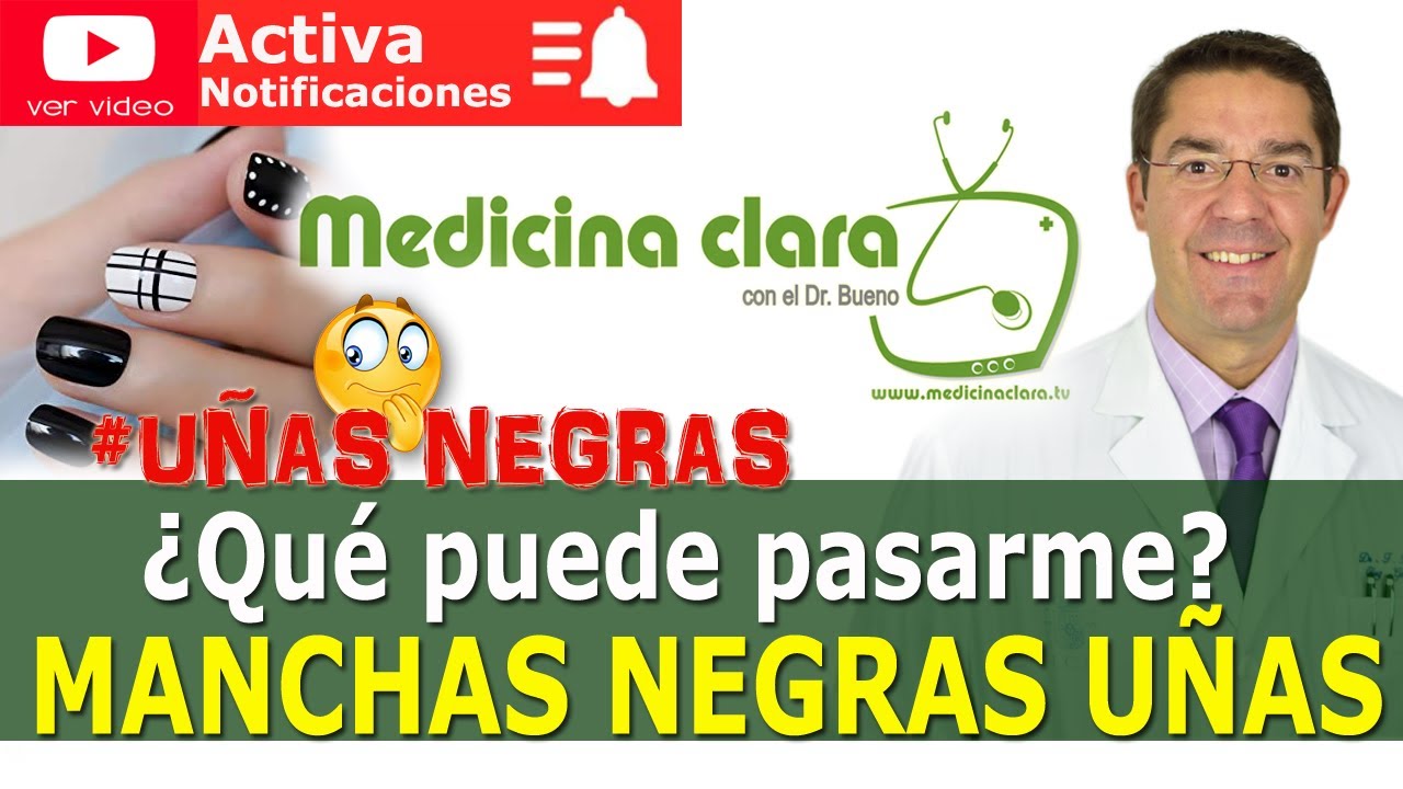 punto negro uña